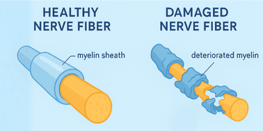 Myelin in a normal nerve fibres vs damaged myelin in MS